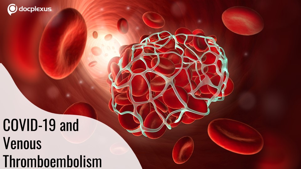 COVID-19 Patients More Likely to Develop a Blood Clot Post-surgery