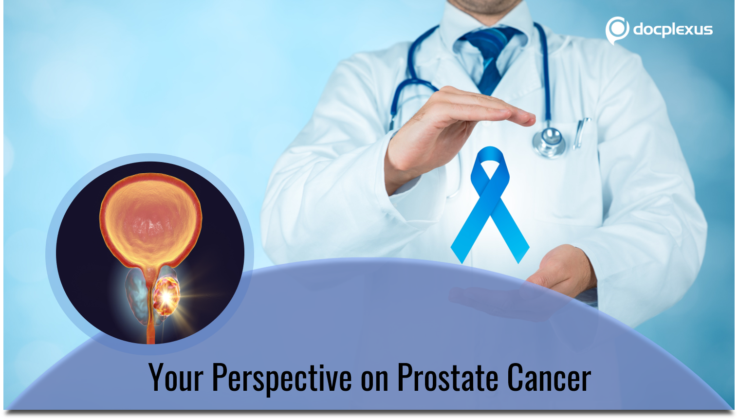 Your Perspective on Prostate Cancer
