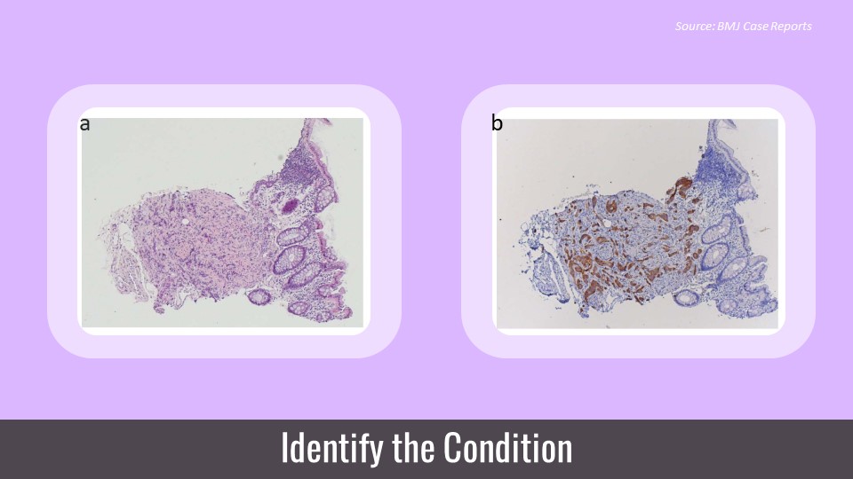 A Coincidental Finding – What’s Your Diagnosis?