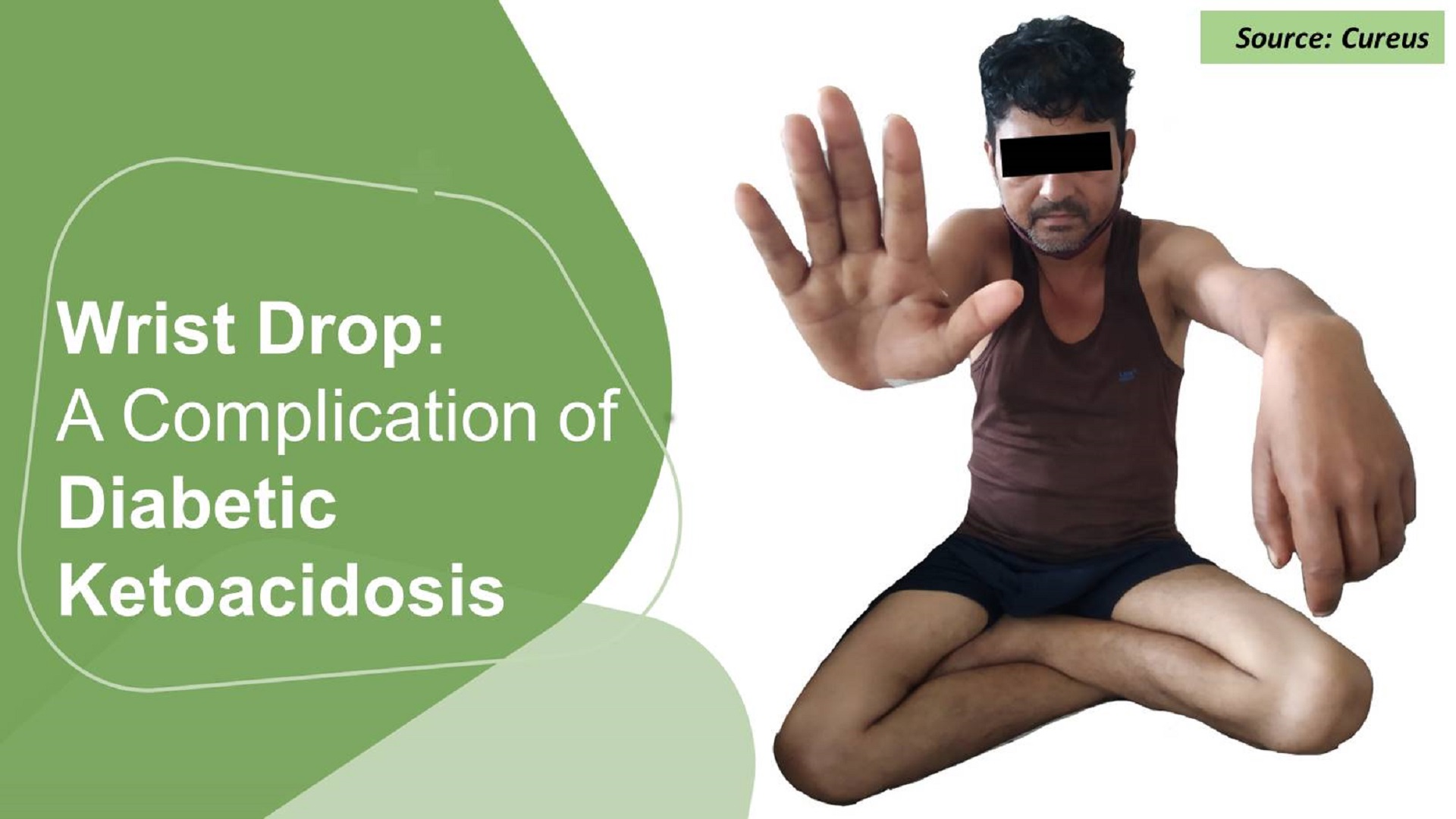 What is the Reason for Wrist Drop in This 45-year-old Patient?