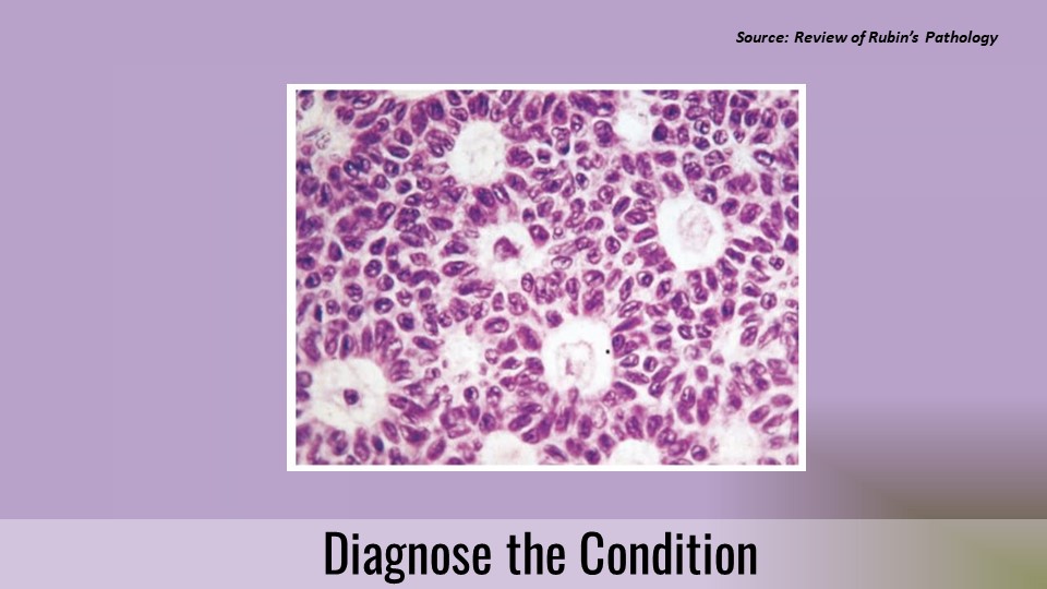 Case of a Woman with Intermittent Vaginal Bleeding