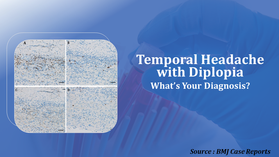 A 78-Year- Old Man with Headache and Diplopia – What’s Your Diagnosis?