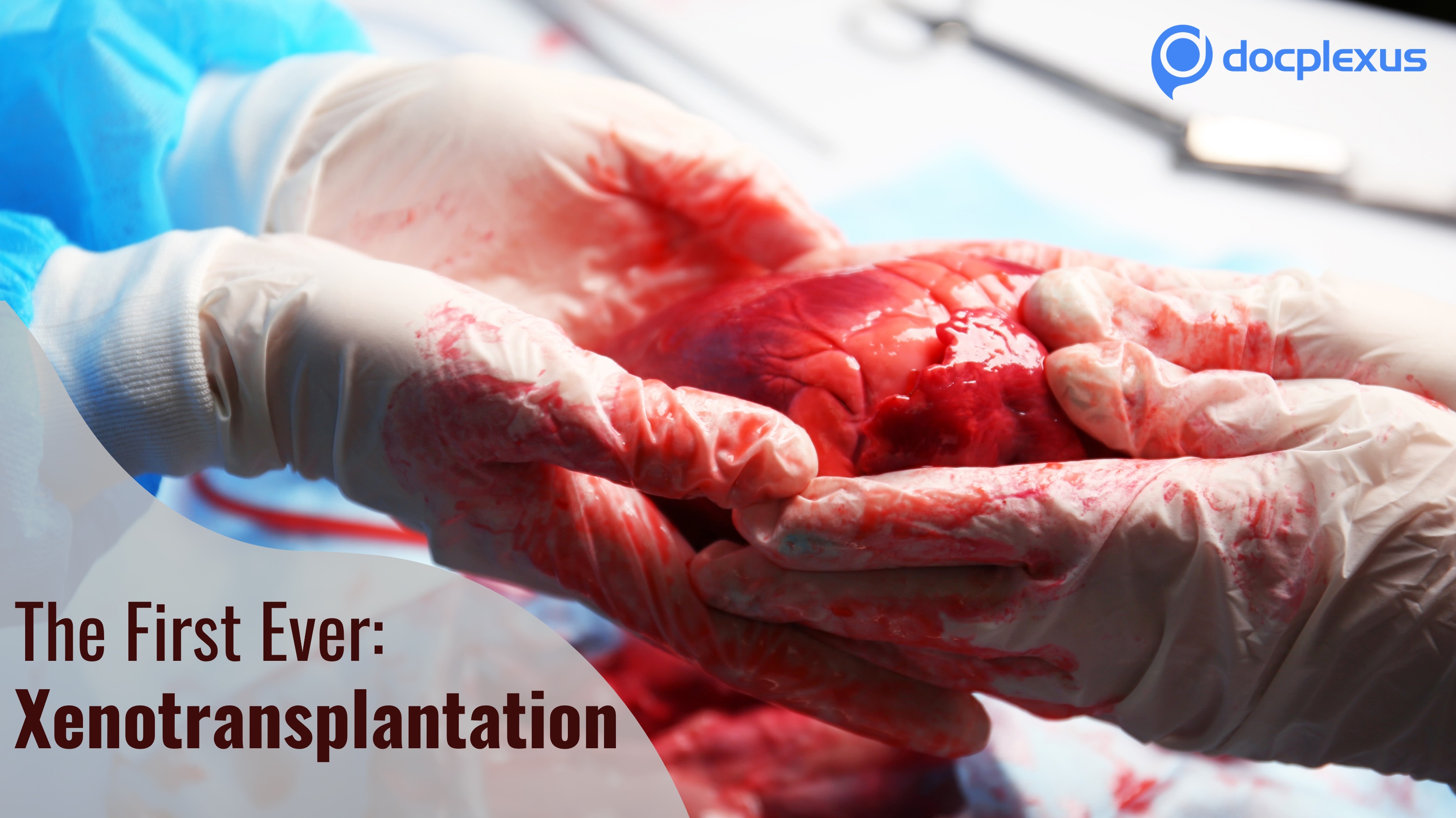 The First-ever Investigational Xenotransplantation