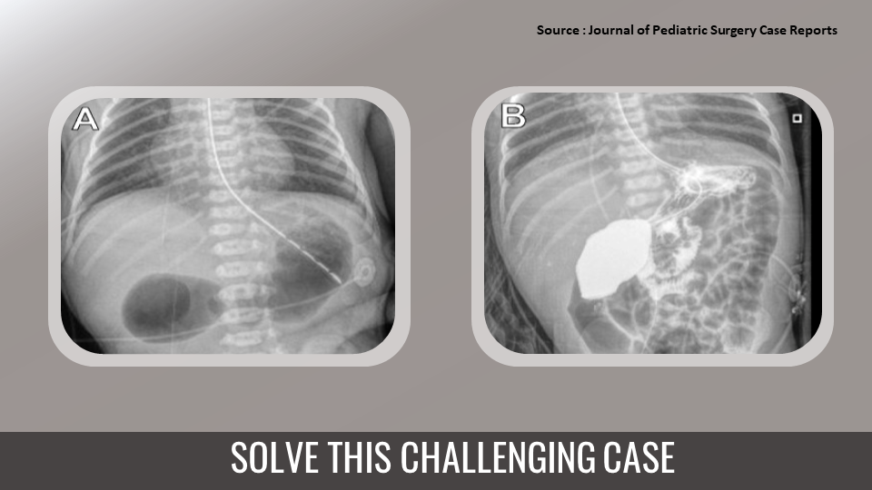 A Rare Case of an Unidentified Etiology in a Newborn – Diagnose the Condition