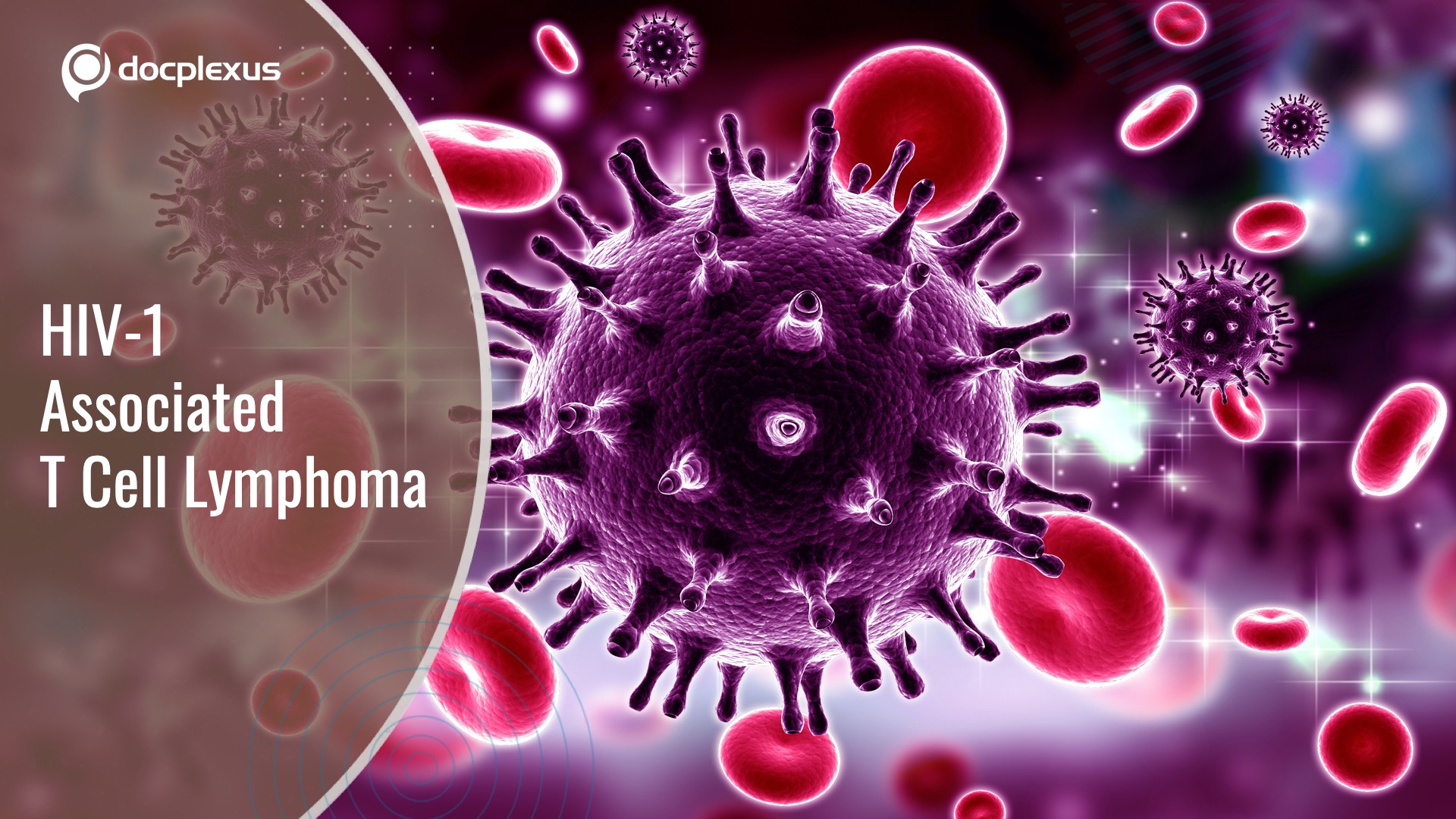 HIV-1: Involvement in the Development of T Cell Lymphoma
