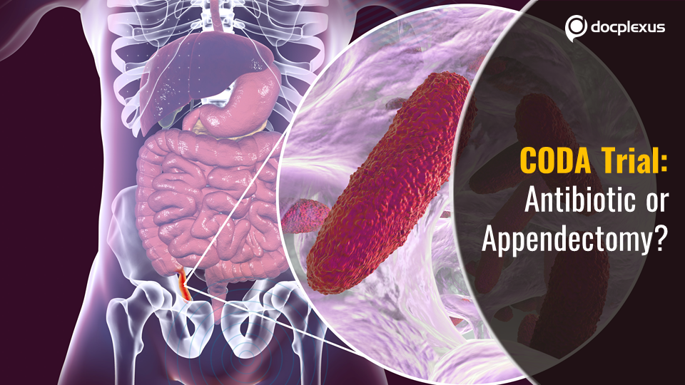 Treating Appendicitis: Antibiotics or Appendectomy?