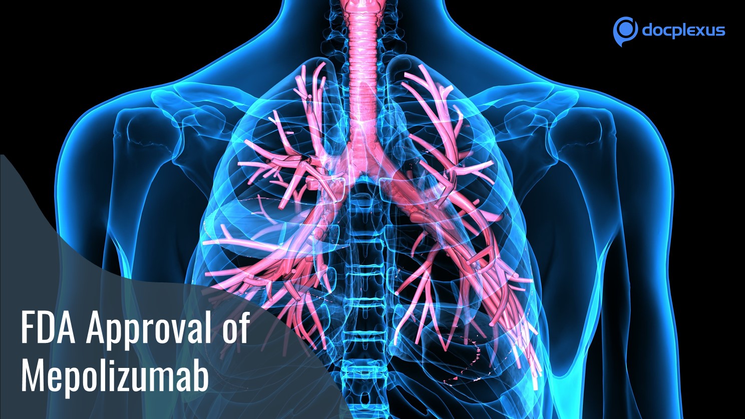 Mepolizumab Approved for Severe Eosinophilic Asthma