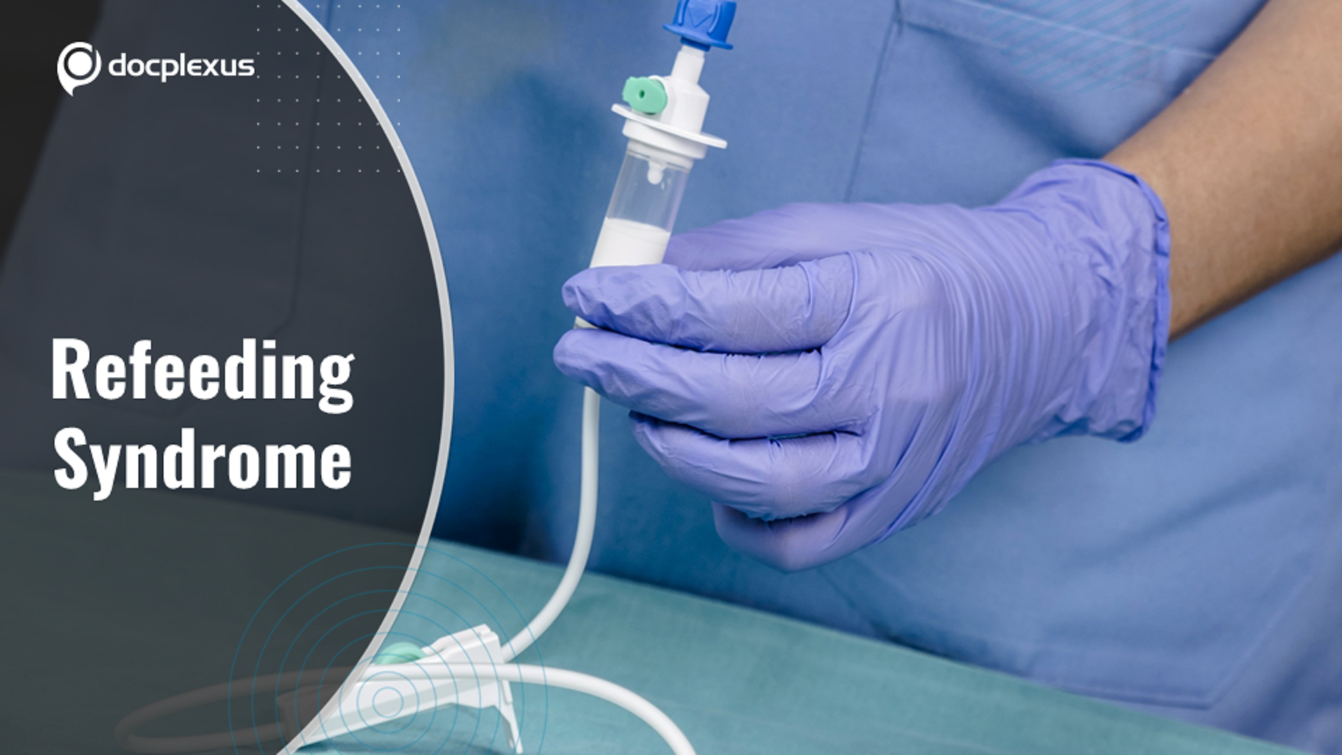 Refeeding Syndrome: A Lesser-known Complication