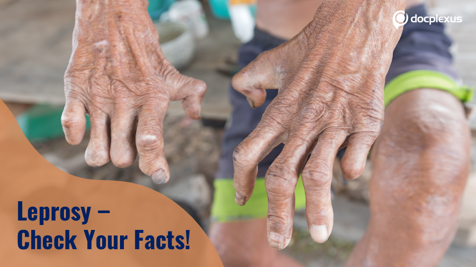 The Leprosy Stigma – Pushing Myths Away!