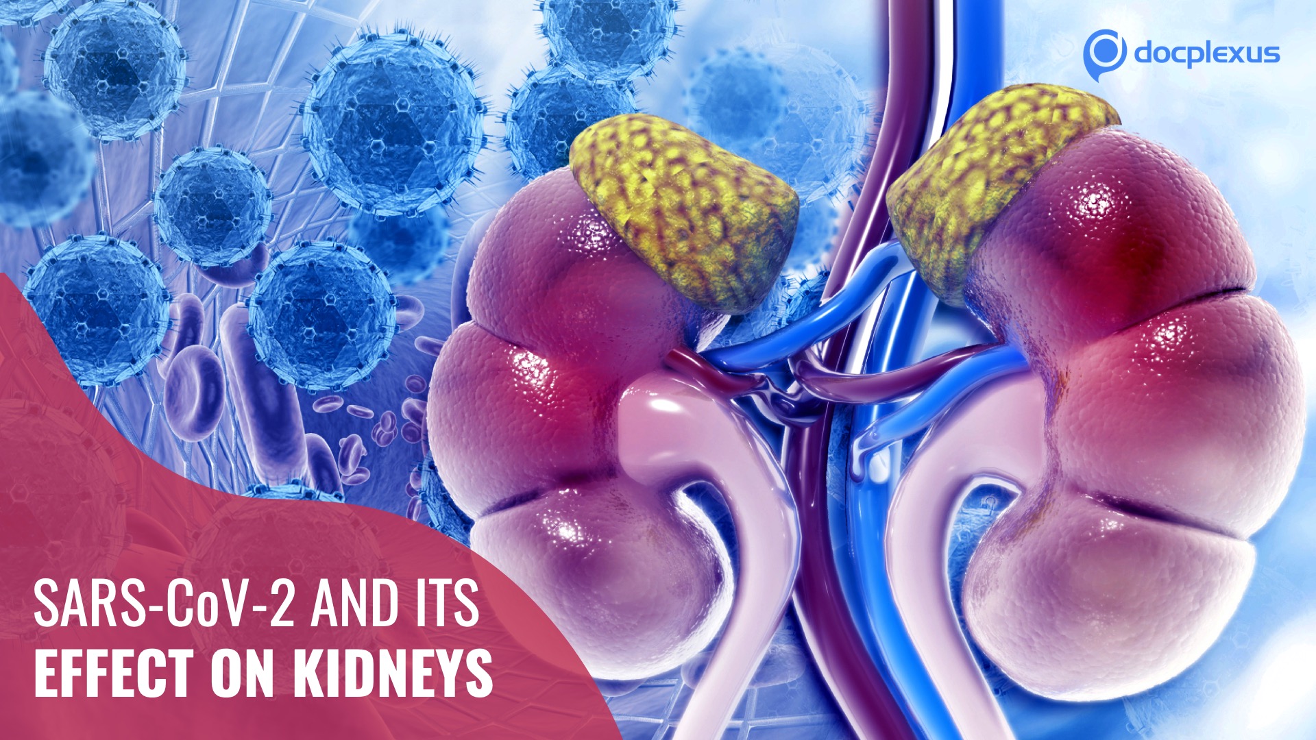 SARS-CoV-2 can Directly Affect Kidneys
