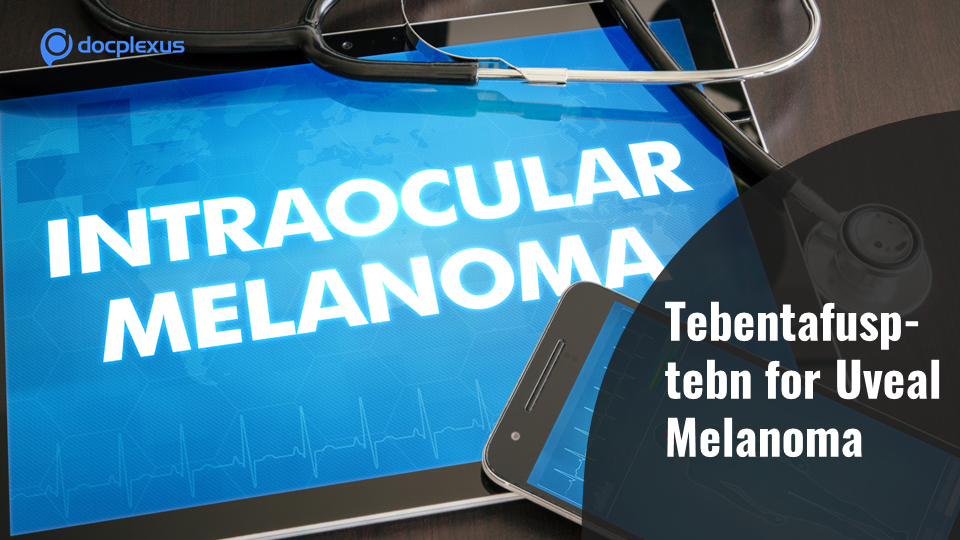 FDA Authorizes Tebentafusp-tebn for Adults with Metastatic Uveal Melanoma
