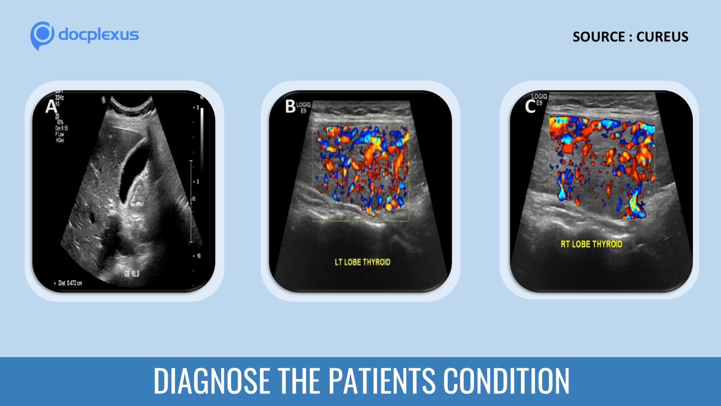 Diagnose This Patient’s Condition