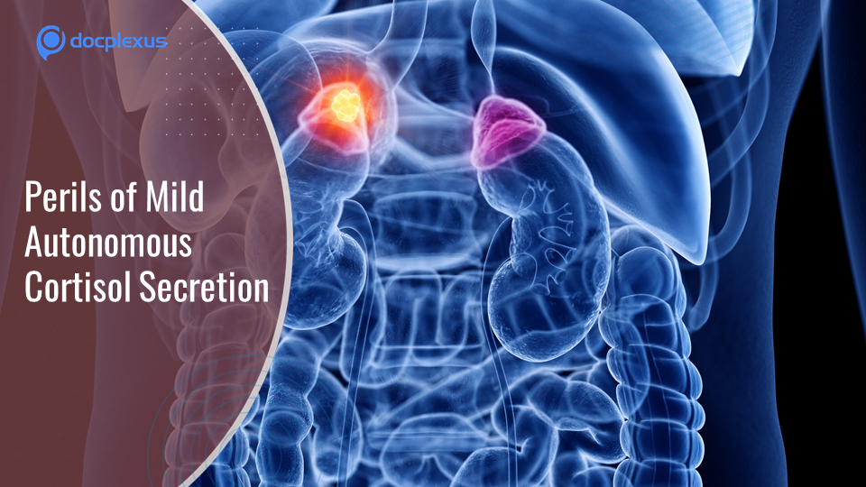 Excess Cortisol Secreting Tumor Linked to Higher Risks of Metabolic Disorders