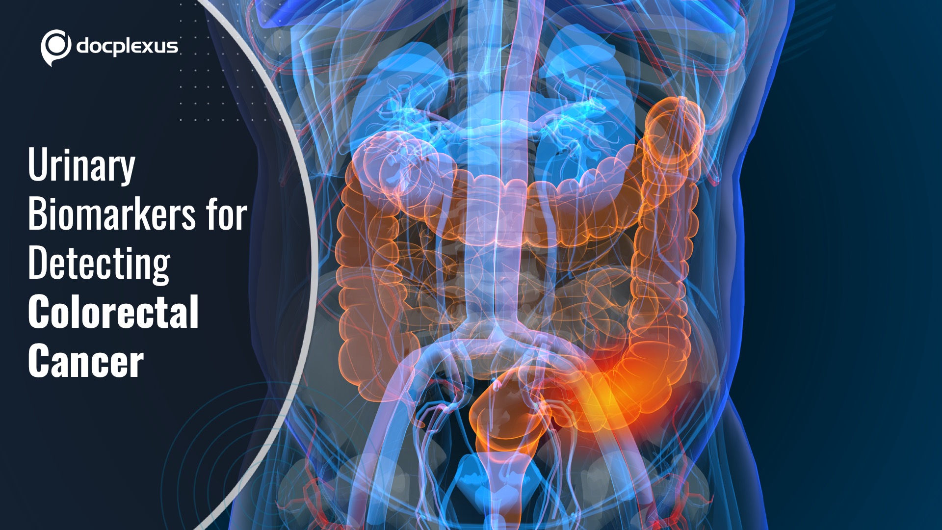 Urinary miRNA Biomarkers for Colorectal Cancer