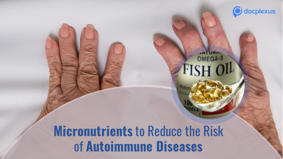 Keeping Autoimmune Diseases at Bay with Vitamin D and Omega 3 Fatty Acid Supplementation