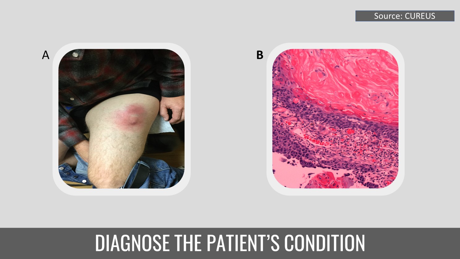 Identify This Rare Condition