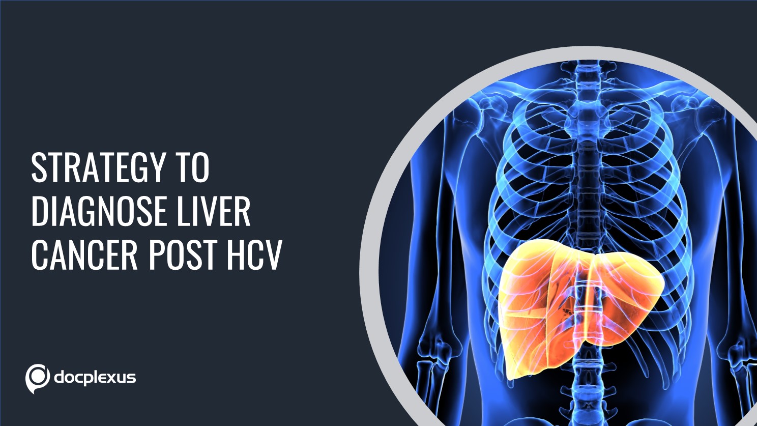 Predicting Liver Cancer Post-HCV Cure