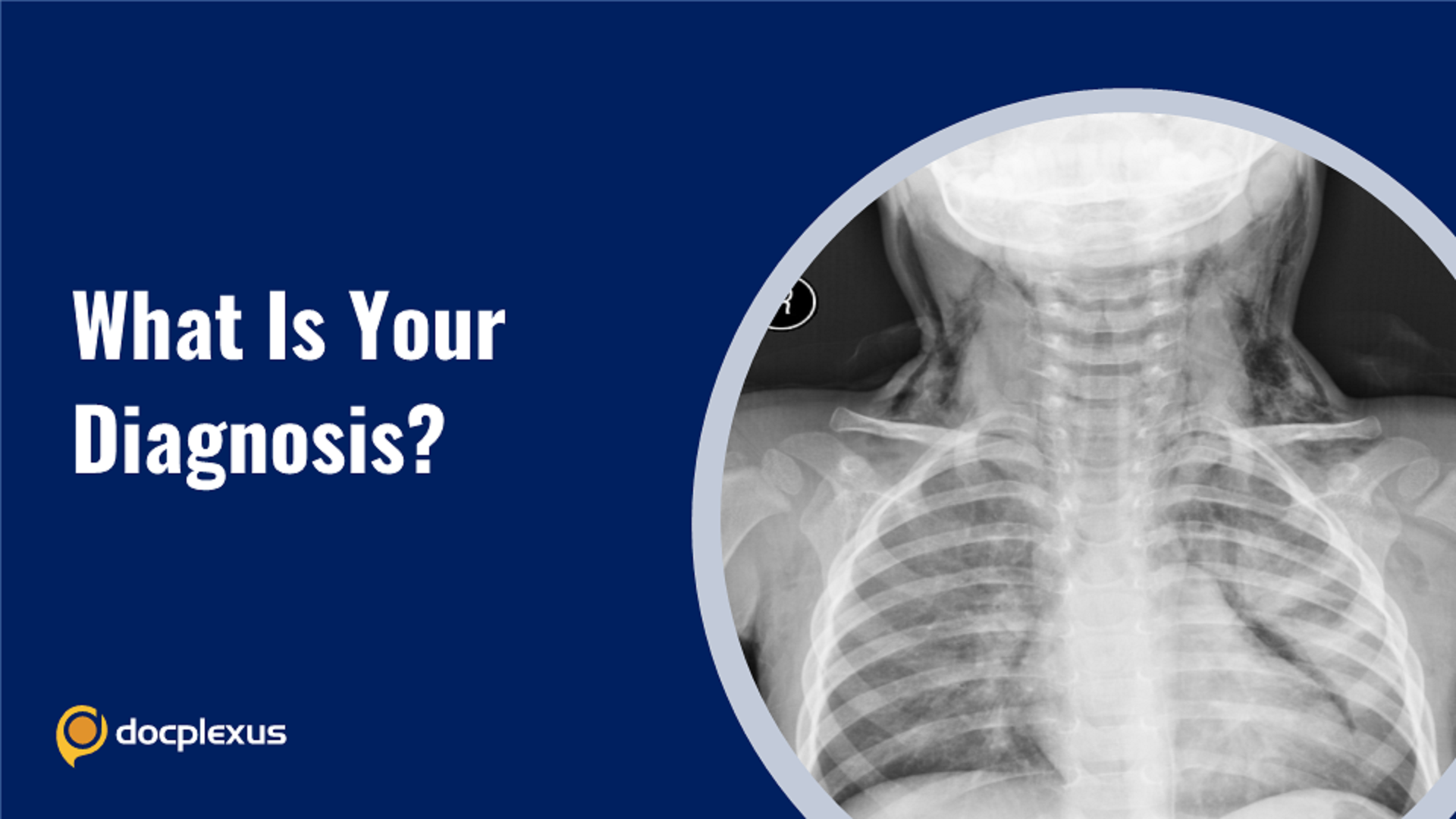 Diagnose This Rare Respiratory Anomaly in a Child