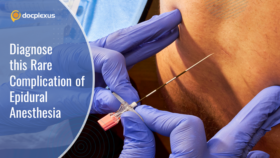 A Complication of Thoracic Epidural Analgesia – What’s Your Diagnosis?