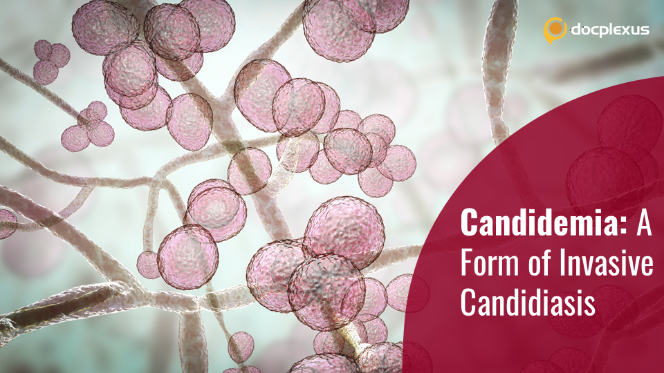 A Brief Overview of Candidemia
