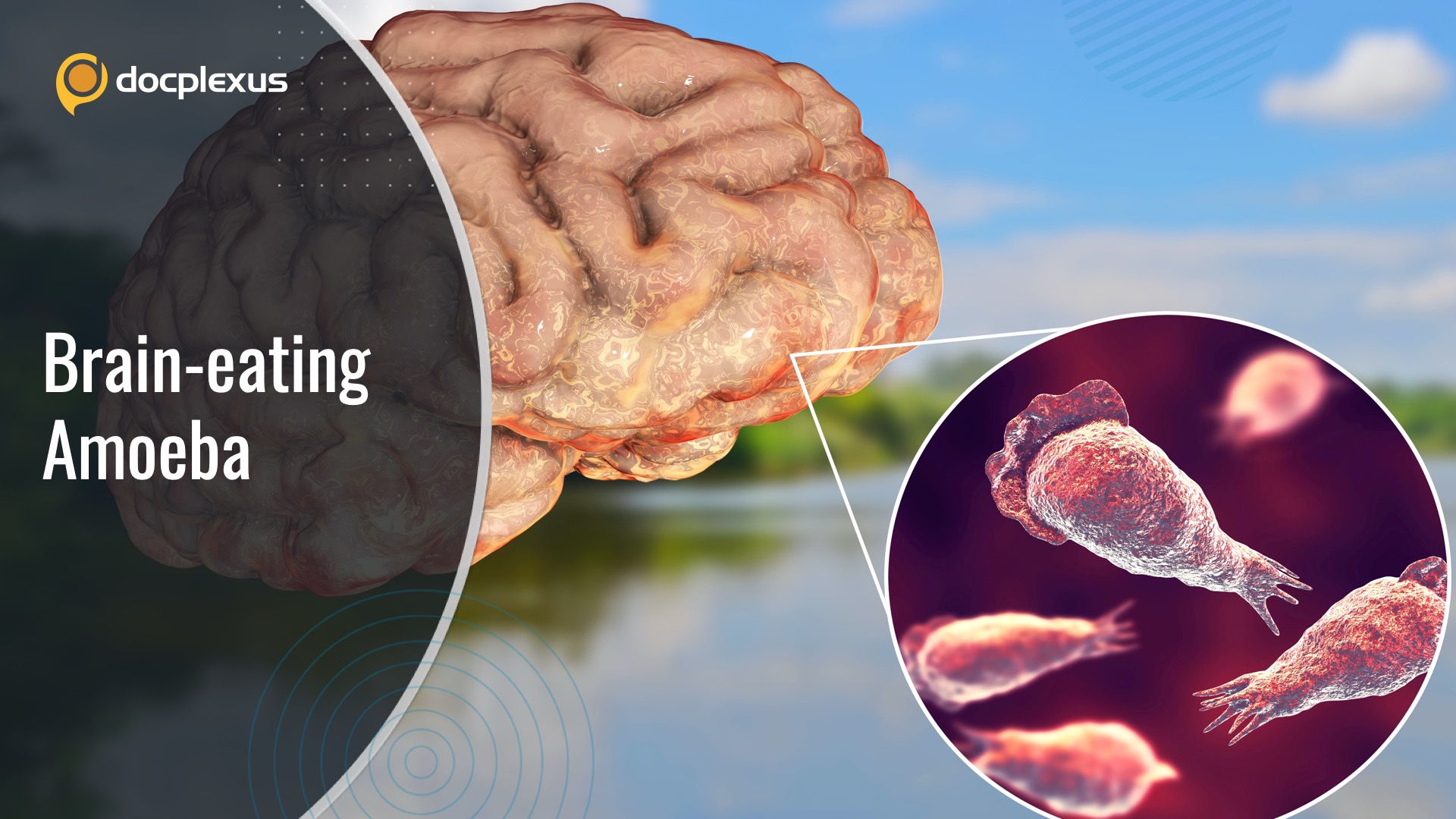 Naegleria fowleri: The Brain-eating Amoeba