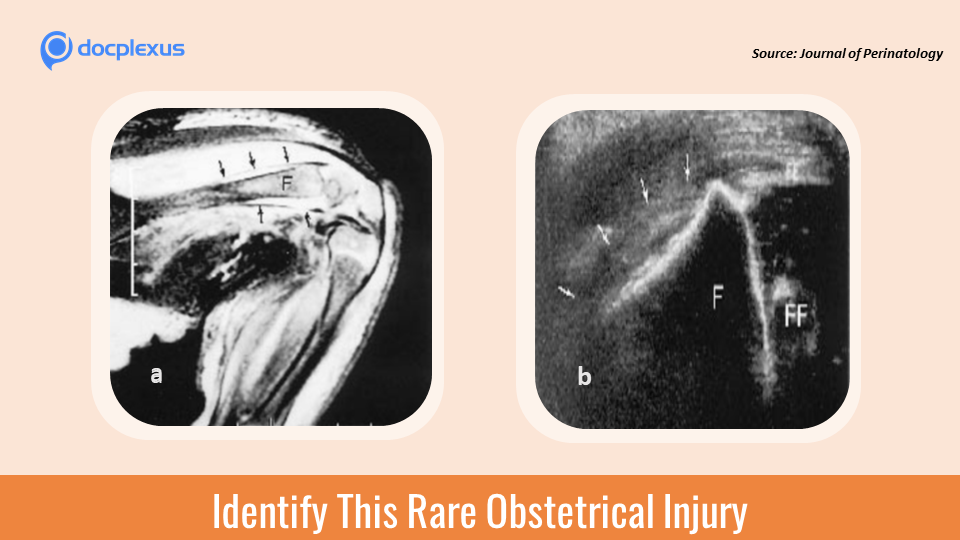 Swelling in the Lower Extremity – Can You Diagnose This Infant’s Condition?