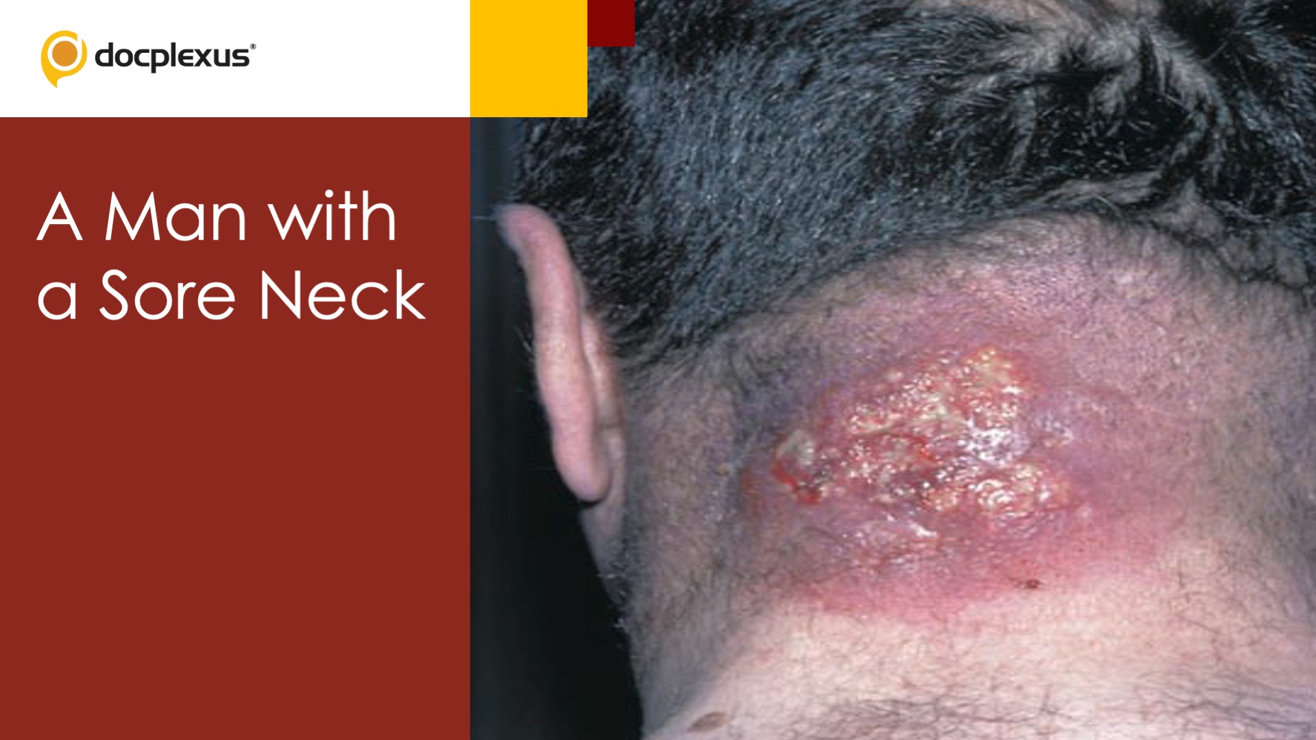 A Man with a Sore Neck