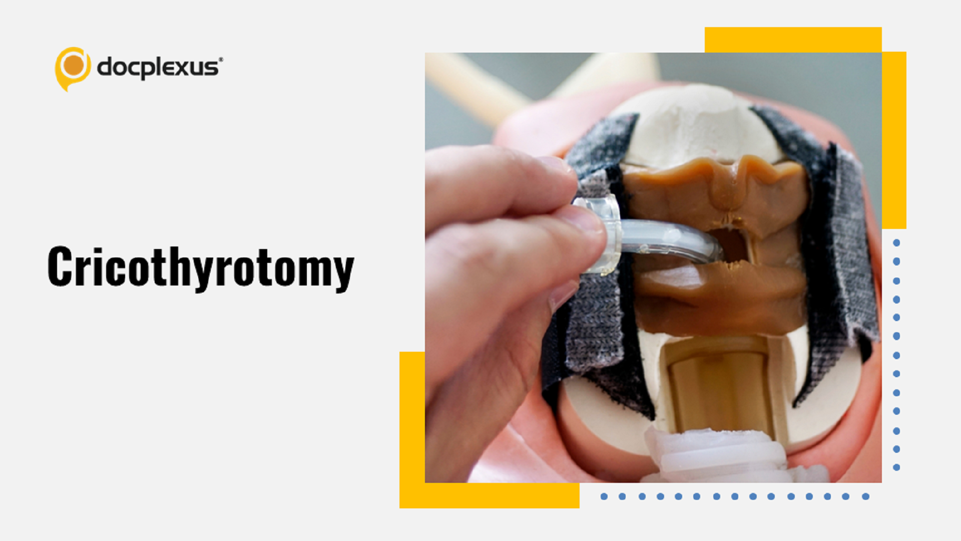Indications & Contraindications for Cricothyrotomy