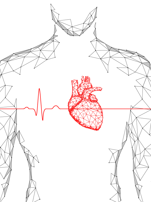 Long-term Outcomes in CABG Surgery