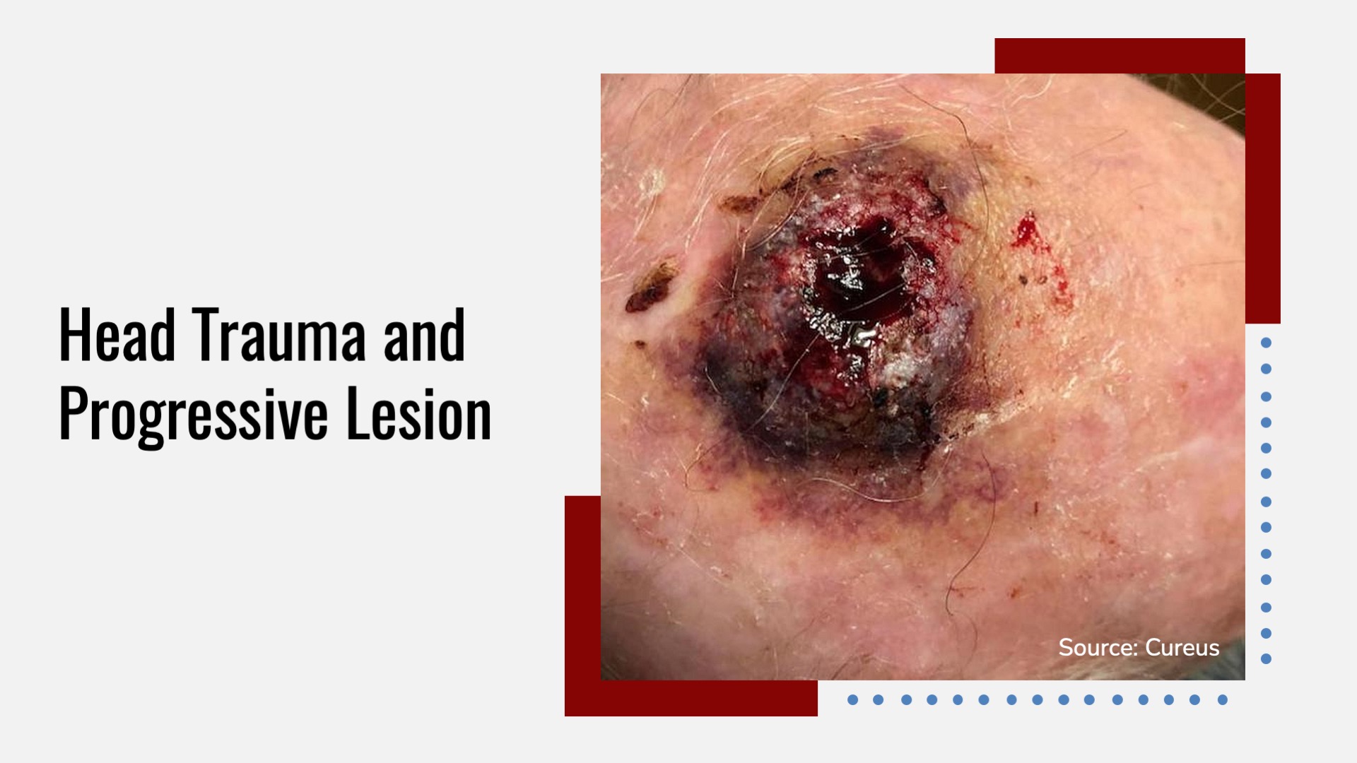 Identify the Lesion Following Head Trauma