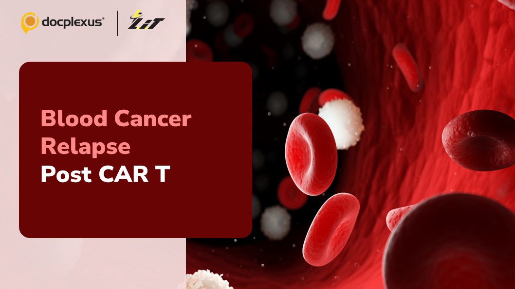 New Treatment Option for Blood Cancer Relapse