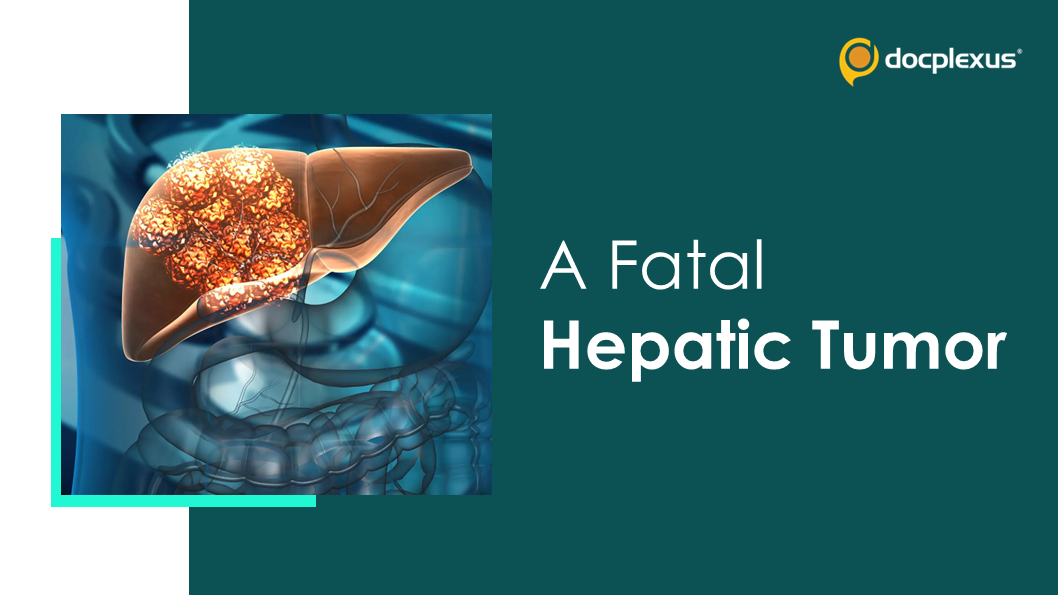 A Fatal Case of Hepatoblastoma
