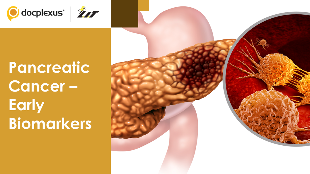 Biomarkers to Predict Pancreatic Cancer Three years in Advance