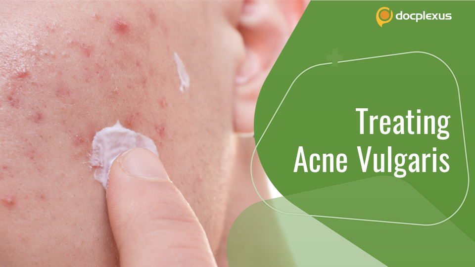 Acne Vulgaris Management Guidelines: American Academy of Dermatology