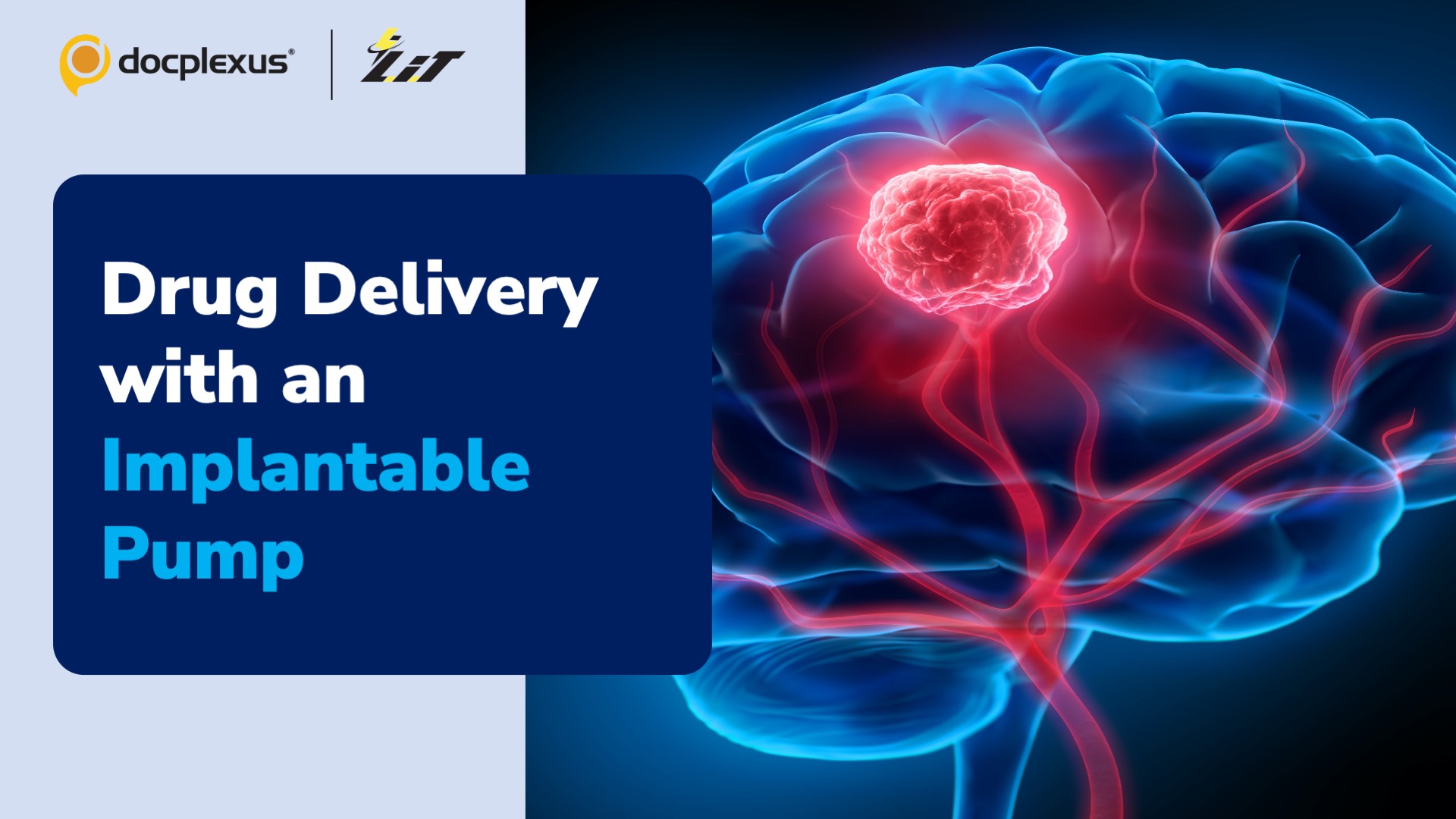 Implantable Drug-delivery Pump to Treat Brain Cancers