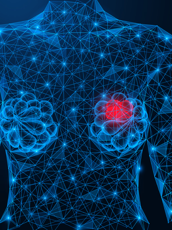 Phyllodes Tumors: Diagnosis, Management and Therapeutic Updates