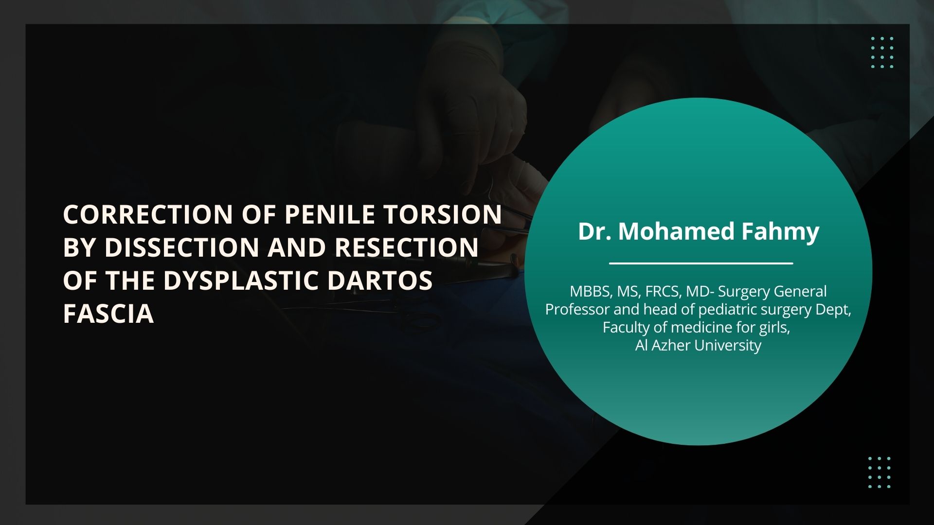 Correction of Penile Torsion by Dissection and Resection of the Dysplastic Dartos Fascia