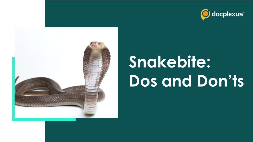 First Aid After Snakebite: A Must-know for Victims