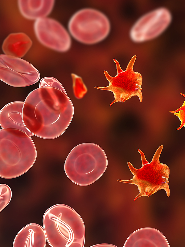 Thrombocytopenia in Children