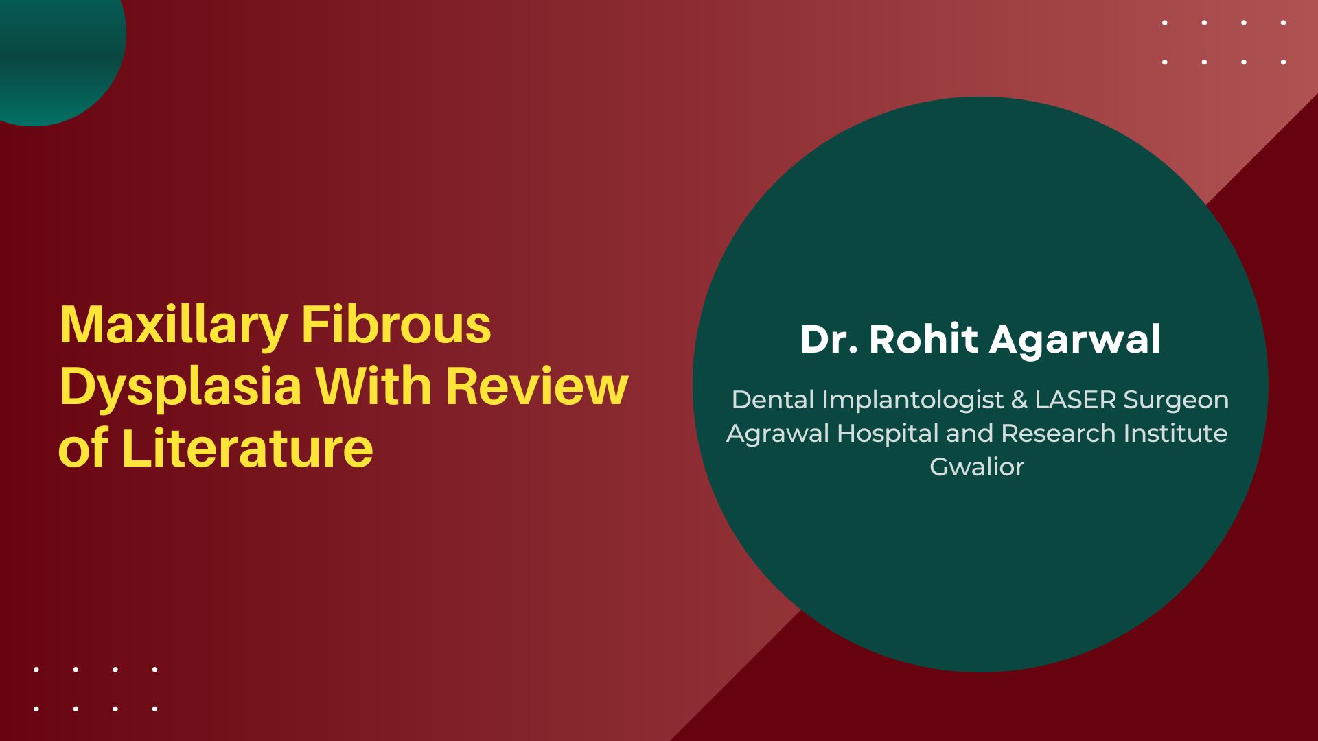 Maxillary Fibrous Dysplasia With Review Of Literature