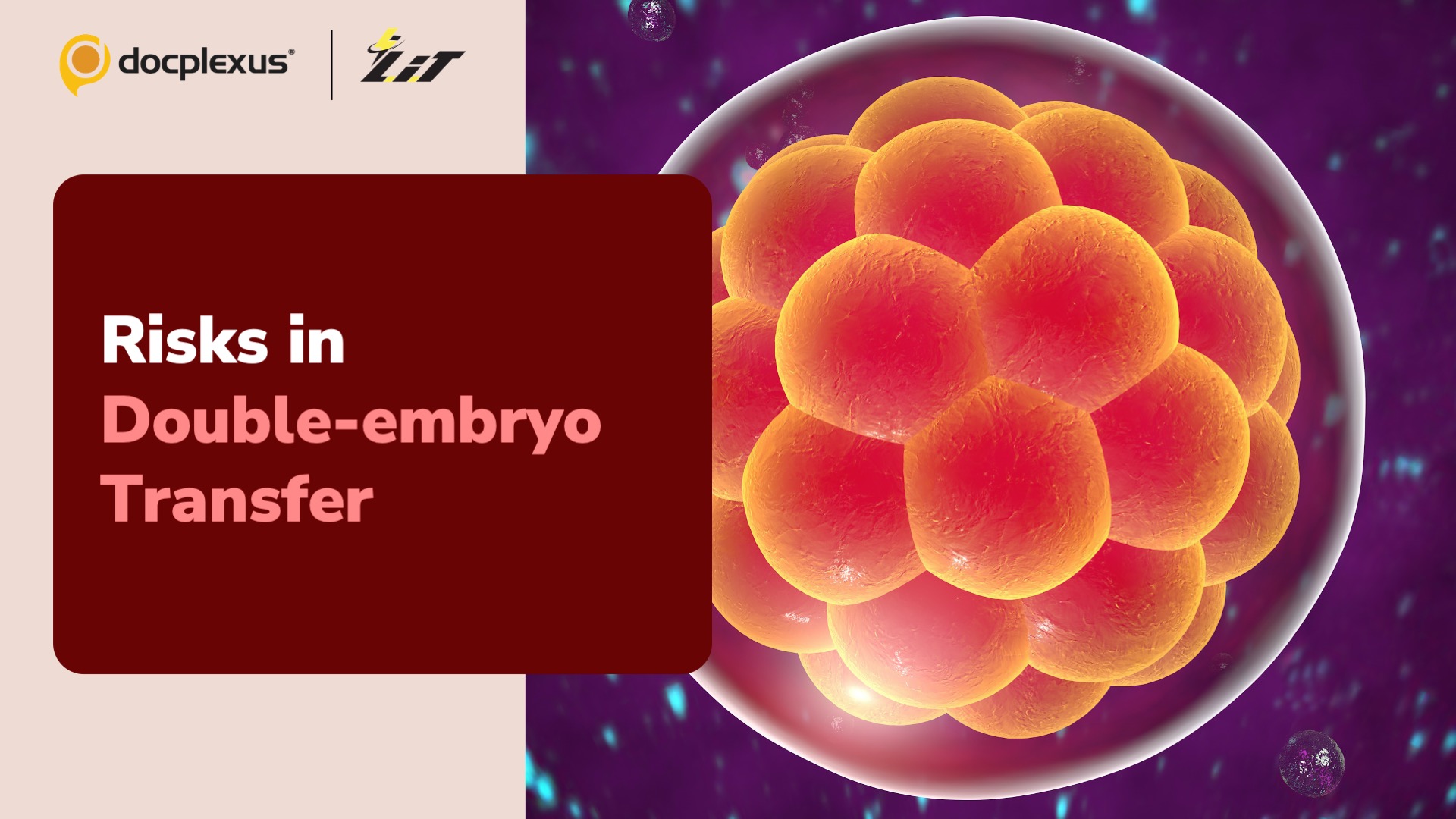 What are the Risks Associated with Double-embryo Transfer in ART?
