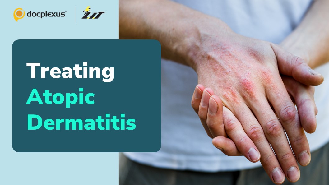 A Novel Monoclonal Antibody Therapy for Treating Dermatitis