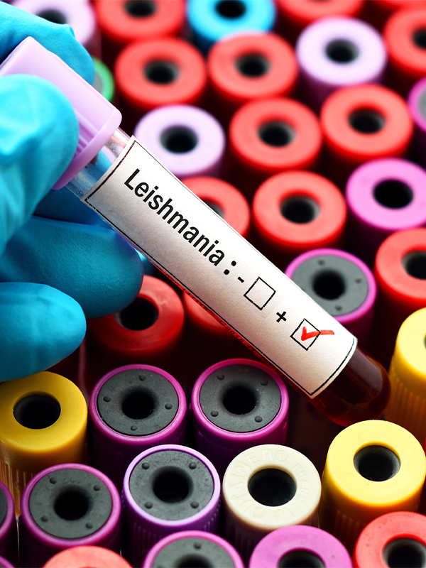 Leishmaniasis: Knowledge Gaps and Challenges