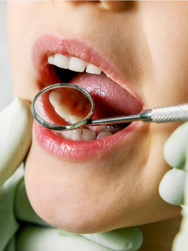 Conquering Challenges in Pediatric Dentistry with NOIS