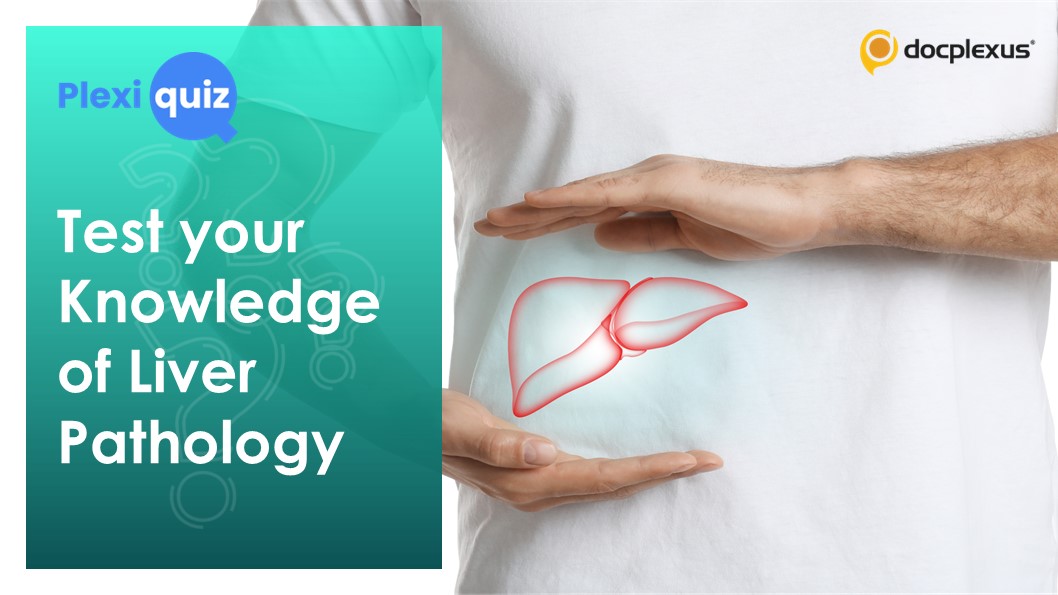 Ace This Quiz on Liver Pathology