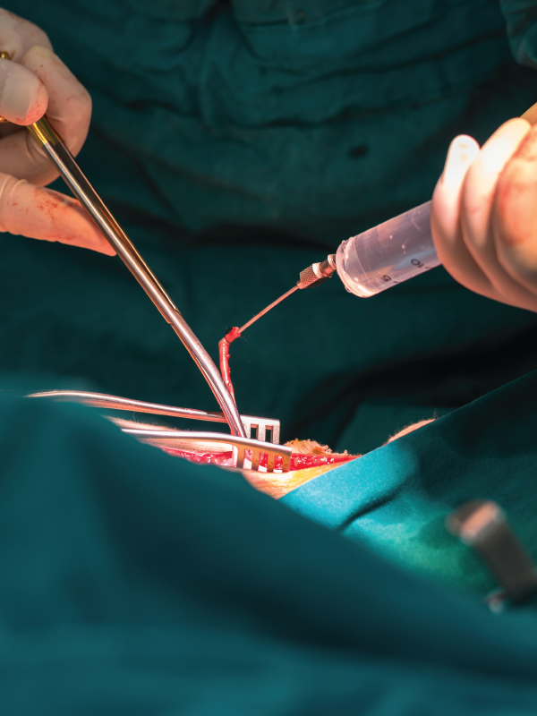 Why and How to Not Destroy the Great Saphenous Vein