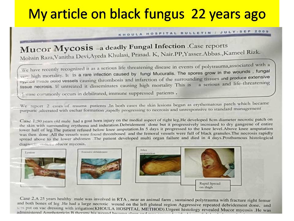 Mucormycosis (Black Fungus) A Deadly Disease