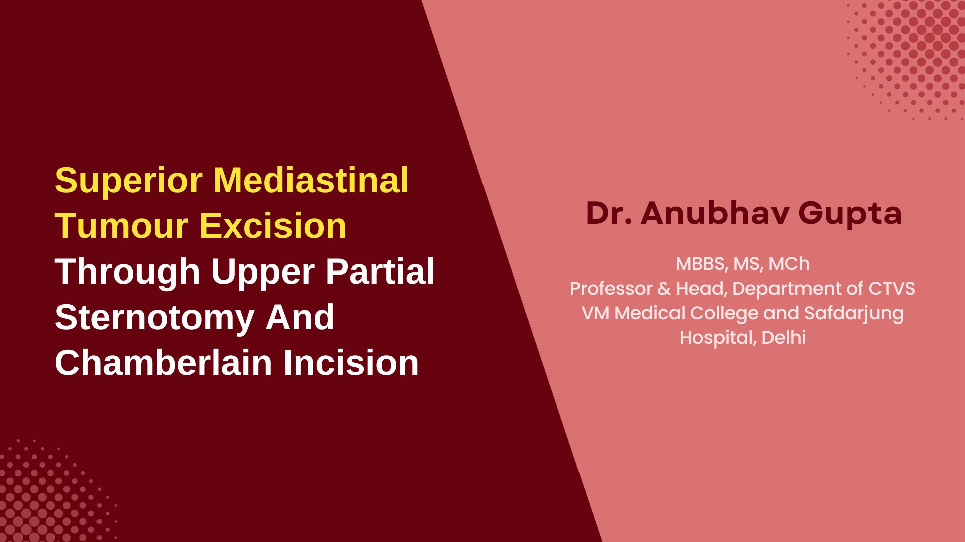 Superior Mediastinal Tumour Excision Through Upper Partial Sternotomy And Chamberlain Incision