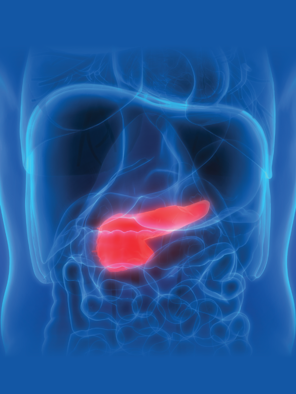 Pancreatic Cystic Neoplasms