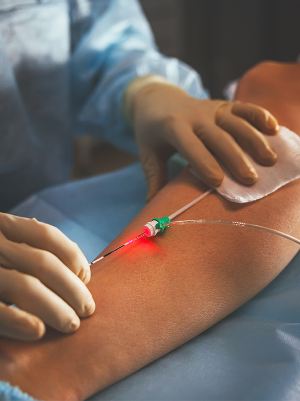 Endovascular Treatment for Prevention and Treatment of the Post-thrombotic Syndrome